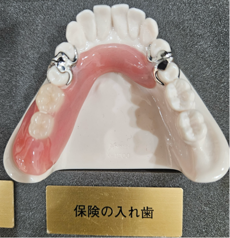 金属（コバルトクラム・チタン）床義歯